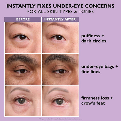 Instant Eye Lift & Face Tightening Cream – Smooths Bags, Puffiness & Fine Lines, No White Residue